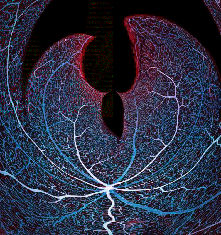11-JasonKirk_20x_MouseRetinalVessels-753x800.jpg