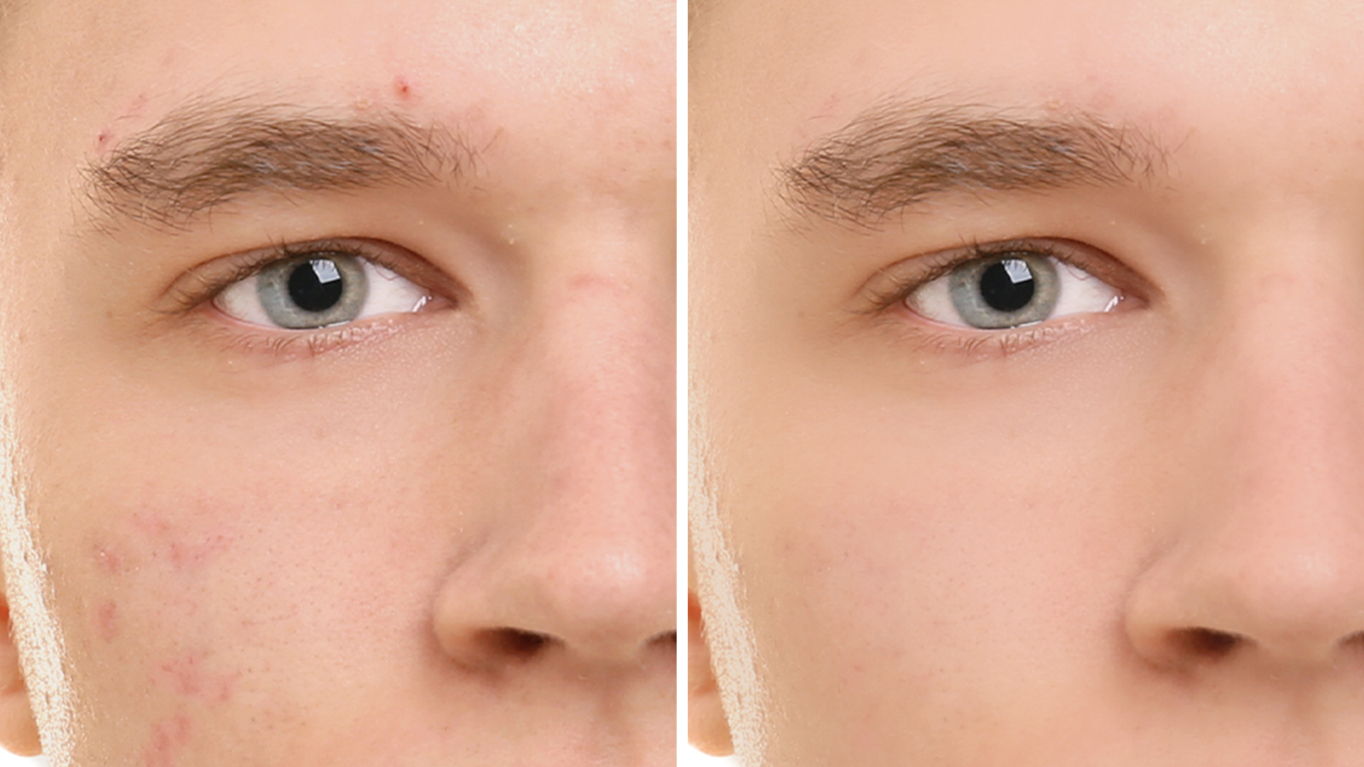 PSE2020_SmoothSkin_1920x1080.png