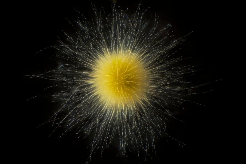 Gloeotrichia - Cyanobacteria, a yellow, spiked planton