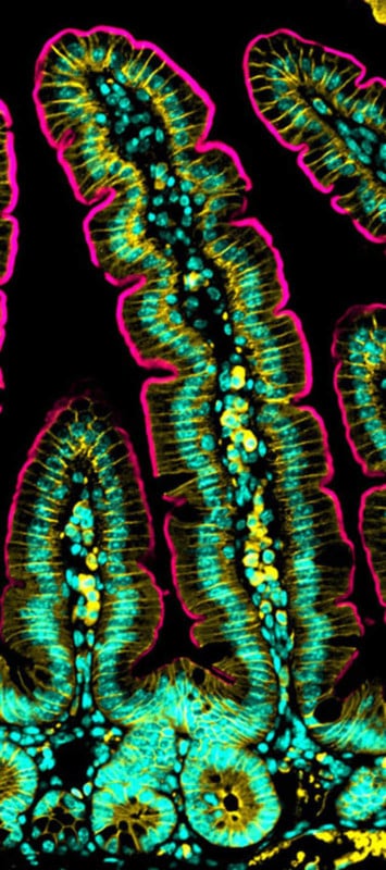 A micrograph of the intestinal villi of a mouse