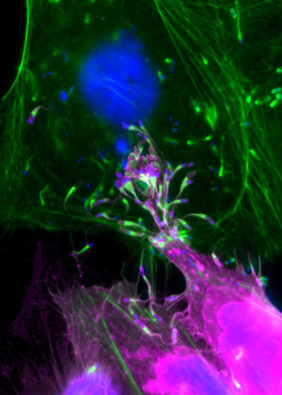 Electron microscope image of HeLa cells infected with Listeria monocytogenes