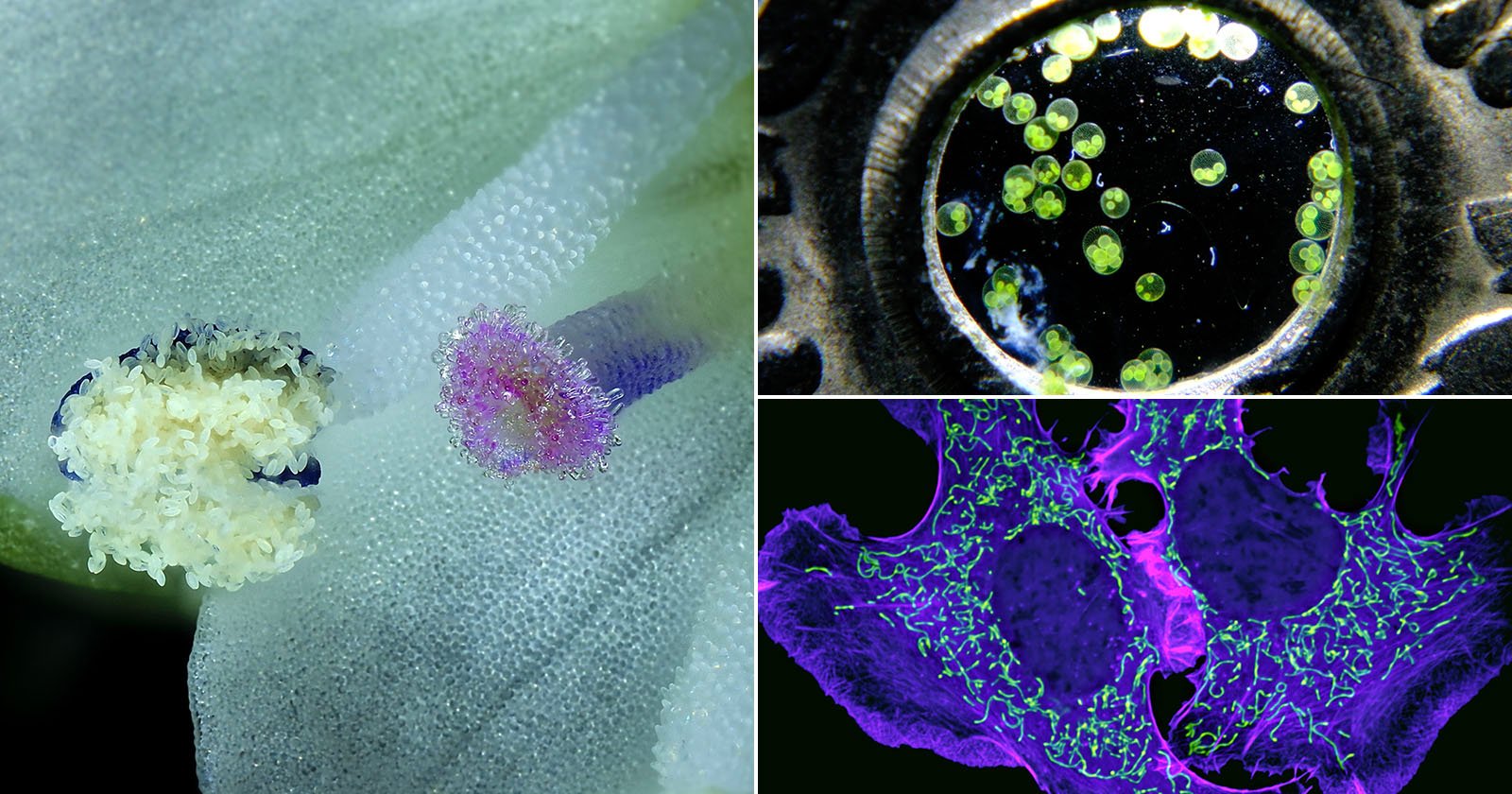 A collage of three microscope images: left, close-up of a flower's reproductive parts; top right, green algae cells next to a metal surface; bottom right, glowing cellular structures in purple and green.