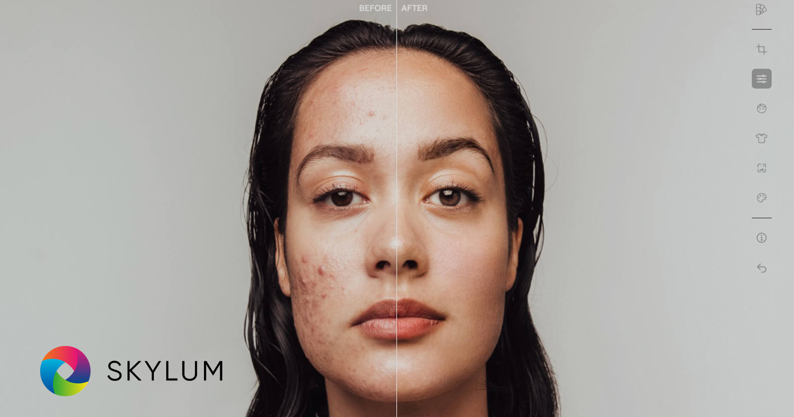 A split image showing a woman's face before and after skin editing. The left side displays blemishes and acne, while the right side is smooth and clear. The word Skylum is in the bottom left corner, accompanied by a colorful circular logo.