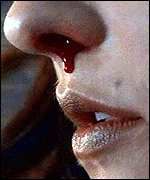 _1145377_nose150.jpg