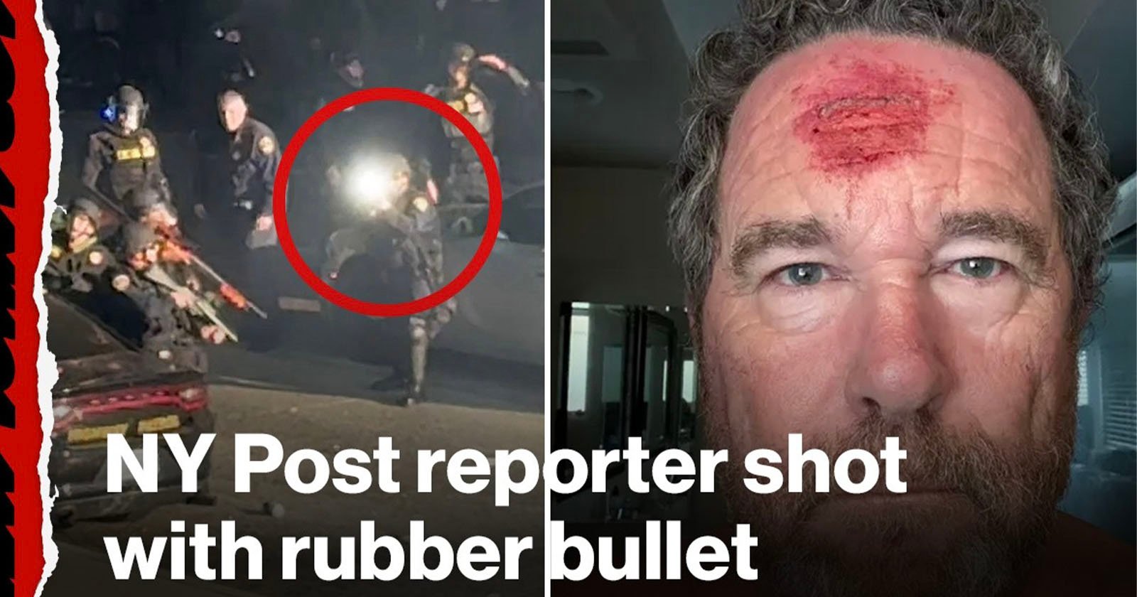 A police officer aims a weapon with a flash of light at night; inset shows a man with a bleeding forehead wound. Text reads: NY Post reporter shot with rubber bullet.