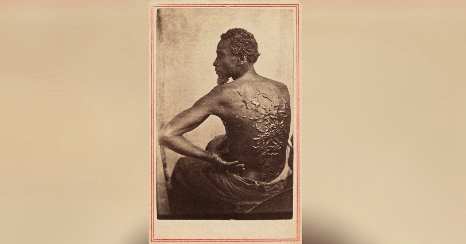 A Black man sits with his back exposed, showing severe scars from whipping. He is turned slightly to the side, highlighting the raised scars across his back. The image is sepia-toned and framed with a thin border.