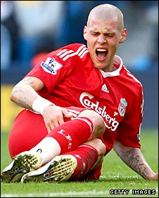 _45081806_skrtel_282.jpg