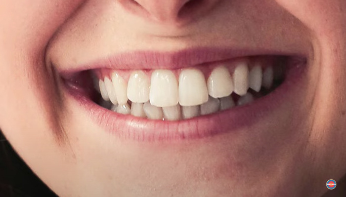 How to Whiten Teeth in Photoshop How to Whiten Teeth in Photoshop