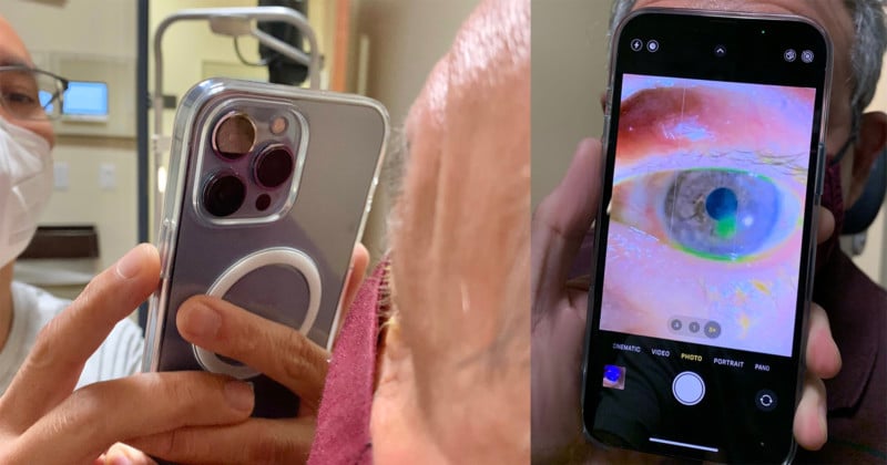 Why-This-Doctor-Uses-the-iPhone-13-Pro-to-Photograph-Patients-Eyes-800x420.jpg